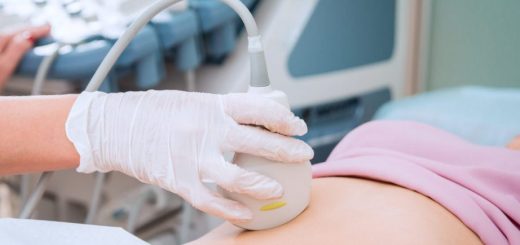 Thấy có nhiều nhân xơ tử cung có nguy hiểm không?