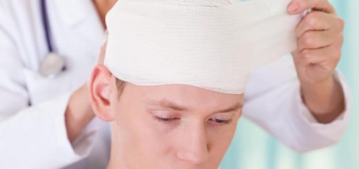 Bị khuyết sọ sau chấn thương sọ não ảnh hưởng gì không?