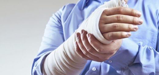 Bị gãy xương quay cổ tay bao lâu hồi phục?