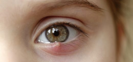 Khóe mắt đau và sưng nhẹ có nguy hiểm?